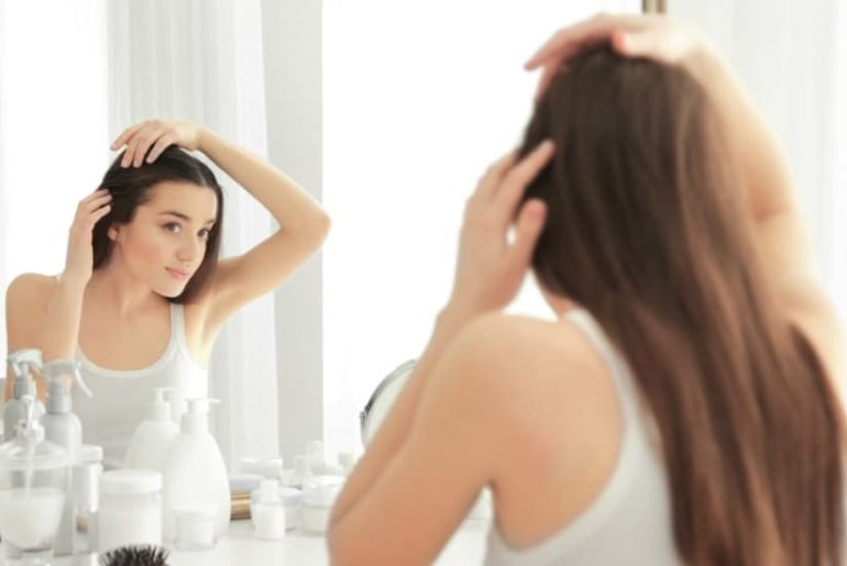alopecia femenina