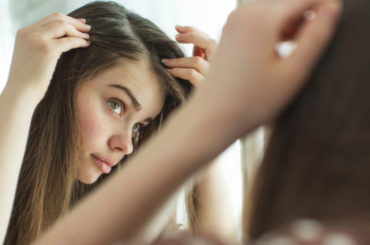 Alopecia frontal fibrosante