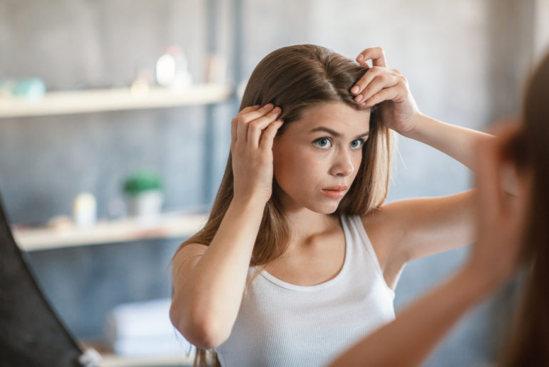 Cómo combatir la alopecia juvenil
